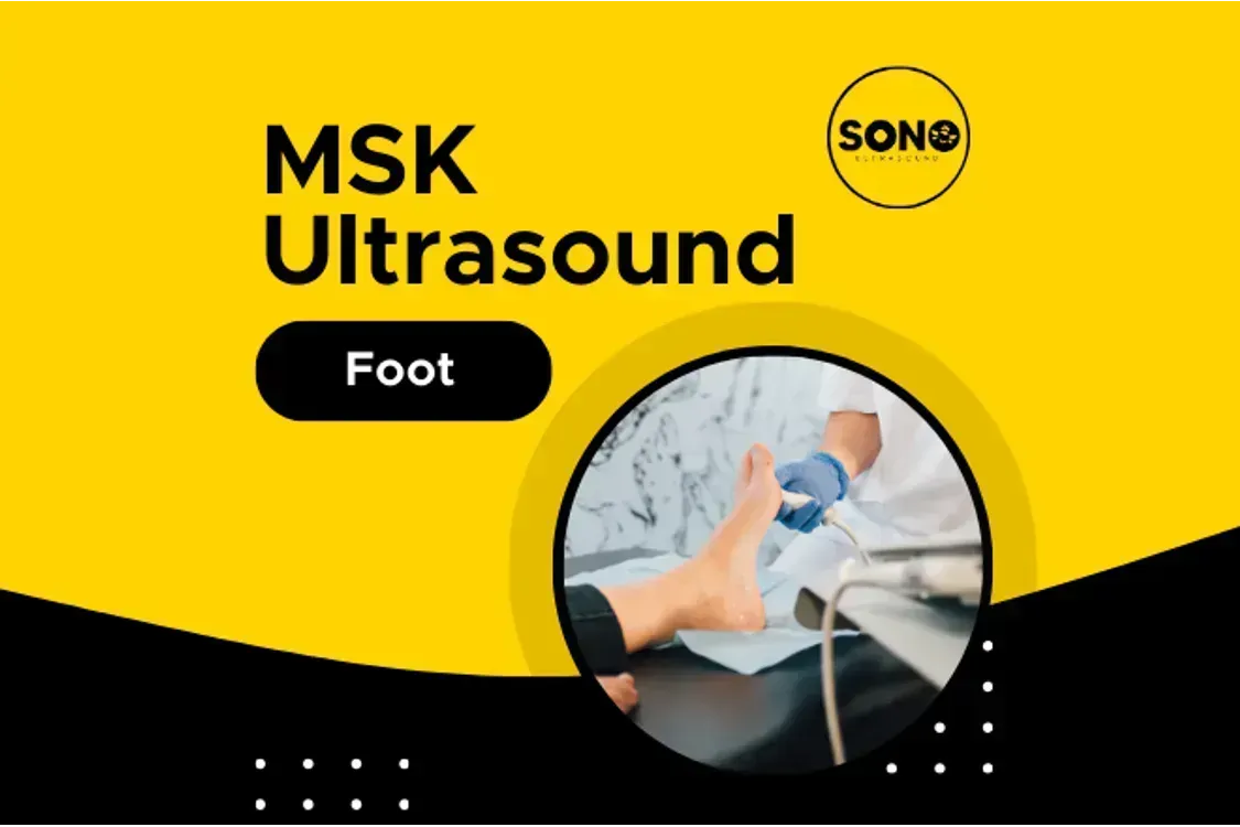 Foot MSK Scan